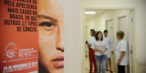 Casos de câncer de pele saltam de 4 mil para mais de 72 mil em 10 anos