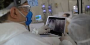 Broncopneumonia: entenda quadro que causou internação de Bolsonaro