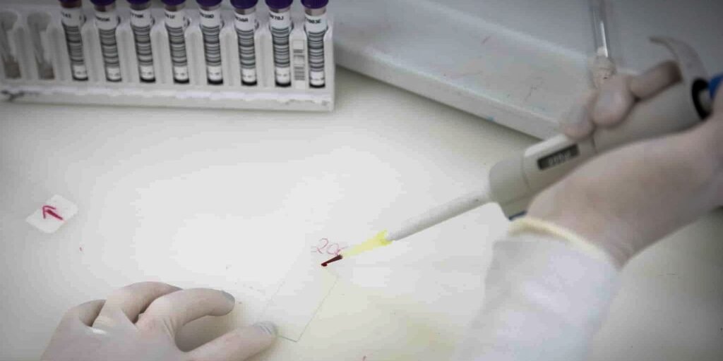 Secretaria de Saúde de SP investiga novo caso suspeito de ebola