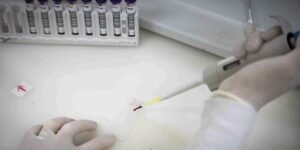 Secretaria de Saúde de SP investiga novo caso suspeito de ebola