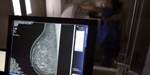 Plano de saúde terá que cobrir mamografia digital para todas as idades